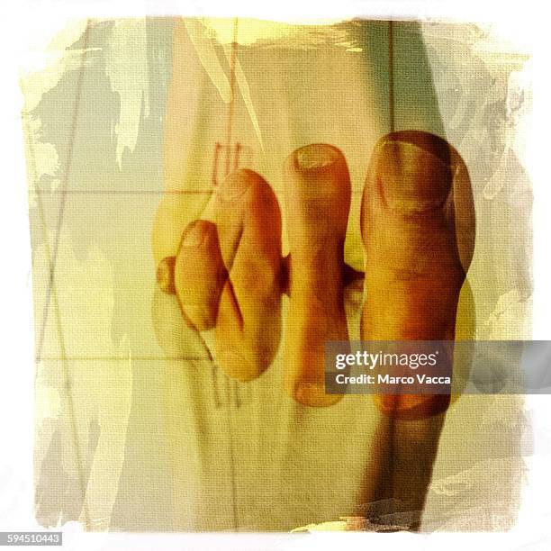 Overlap Fourth Toe 60 Overlapping Toes Stock Photos, High-Res Pictures, and Images - Getty ...