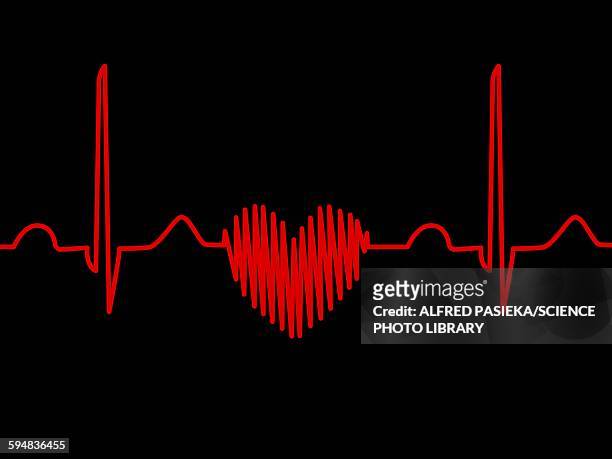 ilustrações de stock, clip art, desenhos animados e ícones de heart-shaped ecg trace - electrocardiography