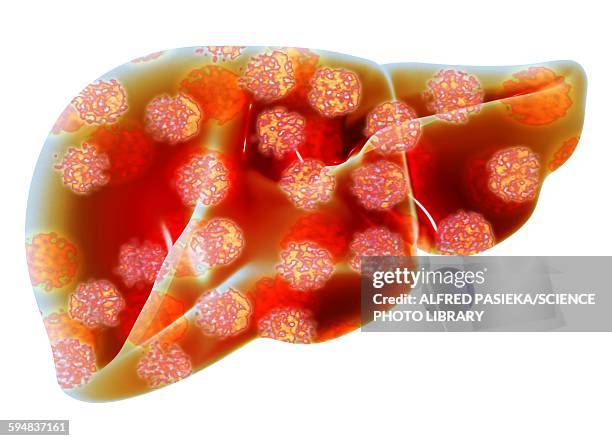 illustrazioni stock, clip art, cartoni animati e icone di tendenza di human liver with hepatitis viruses - human liver