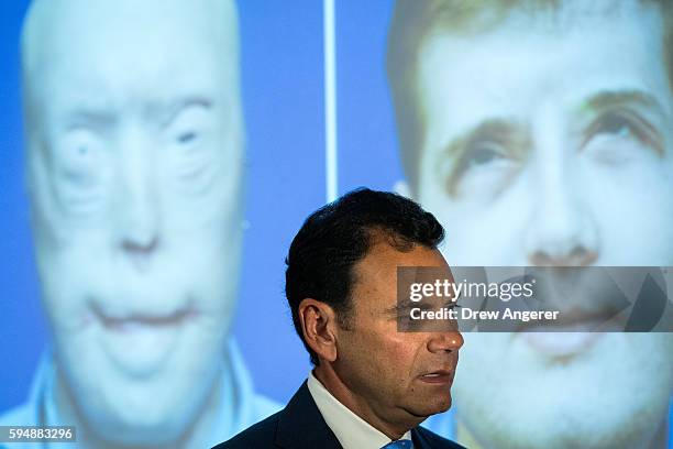 Surgeon Dr. Eduardo Rodriguez speaks to reporters about the recovery of Patrick Hardison, a former firefighter from Mississippi who received a facial...