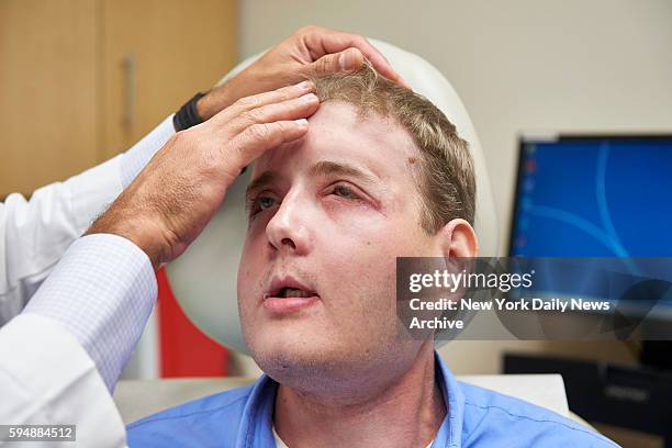 Face transplant patient Patrick Hardison is examined by Dr. Eduardo Rodriguez, Chair of the Hansjörg Wyss Department of Plastic Surgery at NYU...