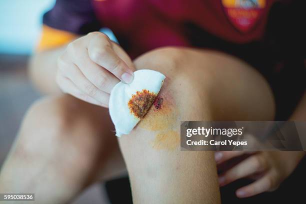 boy with a grazed knee - scraped knee stock pictures, royalty-free photos & images