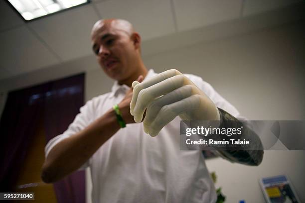 Retired U.S. Army Sergeant Juan Arredondo, a veteran of the war in Iraq, wears the world's first bionic hand known as i-Limb, during a demonstration...