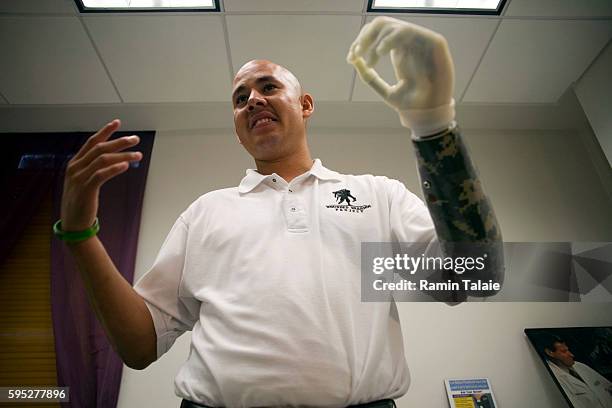 Retired U.S. Army Sergeant Juan Arredondo, a veteran of the war in Iraq, wears the world's first bionic hand known as i-Limb, during a demonstration...