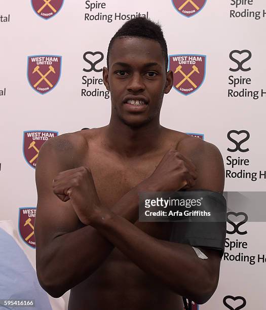 Edimilson Fernandes has his medical at Spire Roding Hospital prior to being unveiled as a West Ham United player at London Stadium on August 25, 2016...