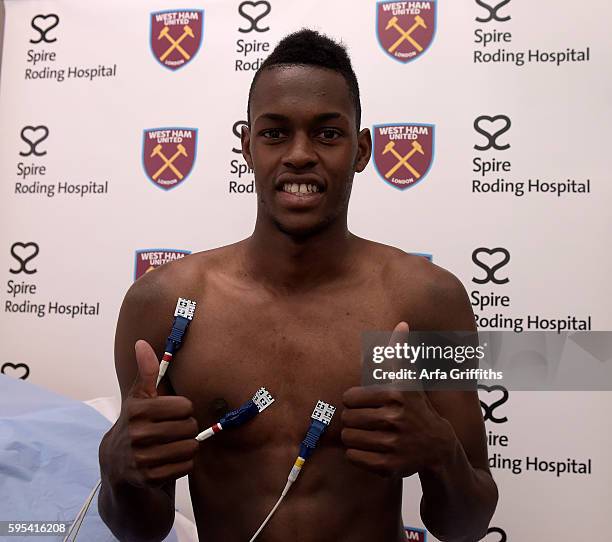 Edimilson Fernandes has his medical at Spire Roding Hospital prior to being unveiled as a West Ham United player at London Stadium on August 25, 2016...