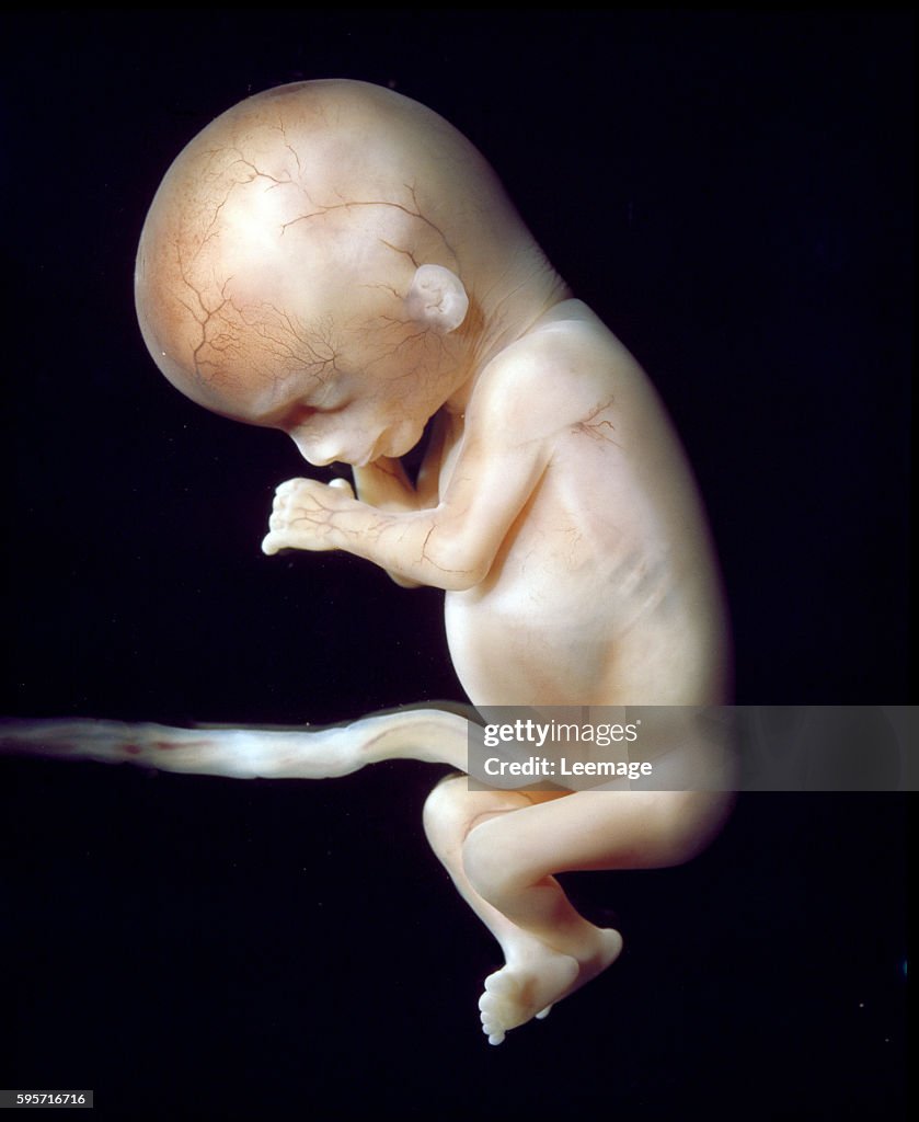 Human fetus enclosed in the amniotic sac during the fourteenth week of development