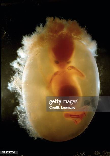 Human fetus