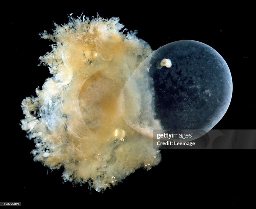 Human embryo enclosed in the amniotic sac during the second week of development