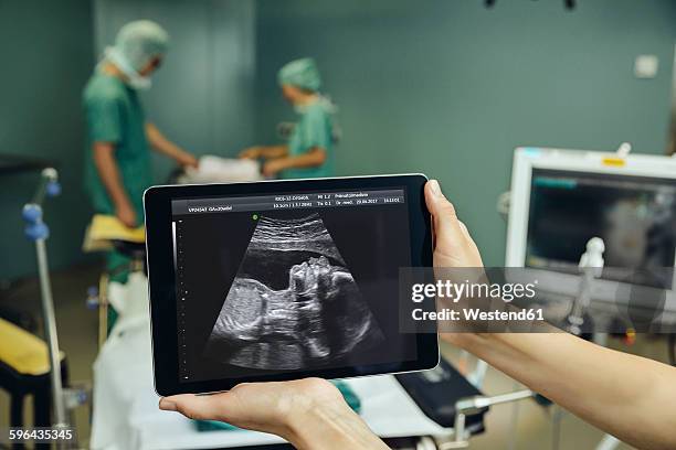 hands holding a digital tablet showing an ultrasound image of a fetus in surgery room - foetus stockfoto's en -beelden