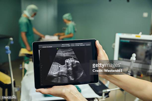 hands holding a digital tablet showing an ultrasound image of a fetus in surgery room - foster bildbanksfoton och bilder