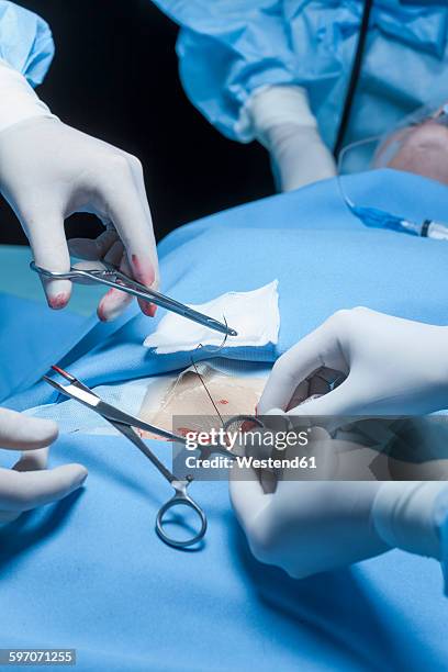 Body Operation Thread 186 Operation Thread Stock Photos, High-Res Pictures, and Images ...