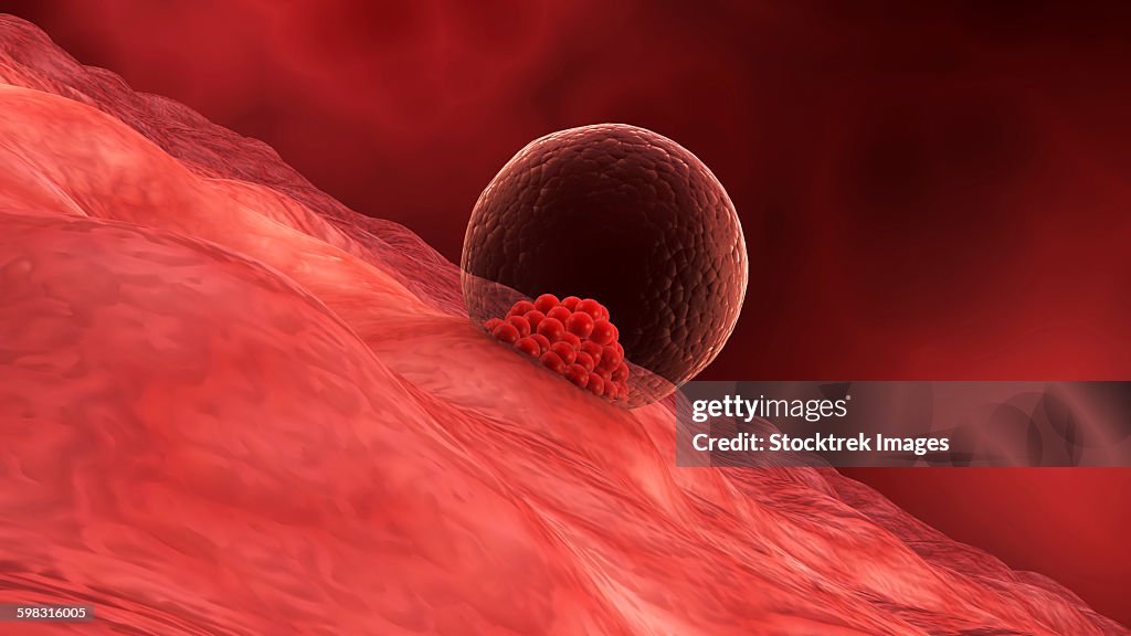 A blastocyst begins implanting in the wall of the uterus.