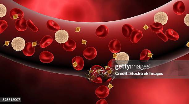 ilustrações, clipart, desenhos animados e ícones de blood clotting inside artery. - fibrin