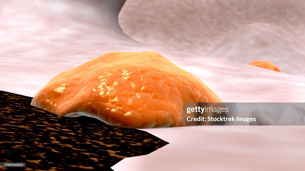 Osteoclast breaking down bone tissue.