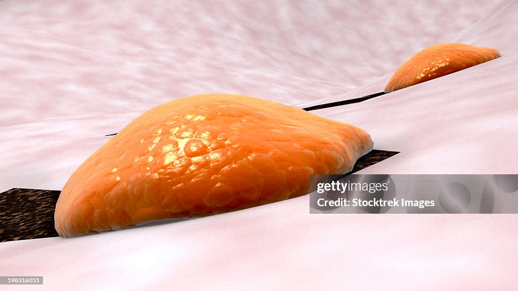 Osteoclast breaking down bone tissue.