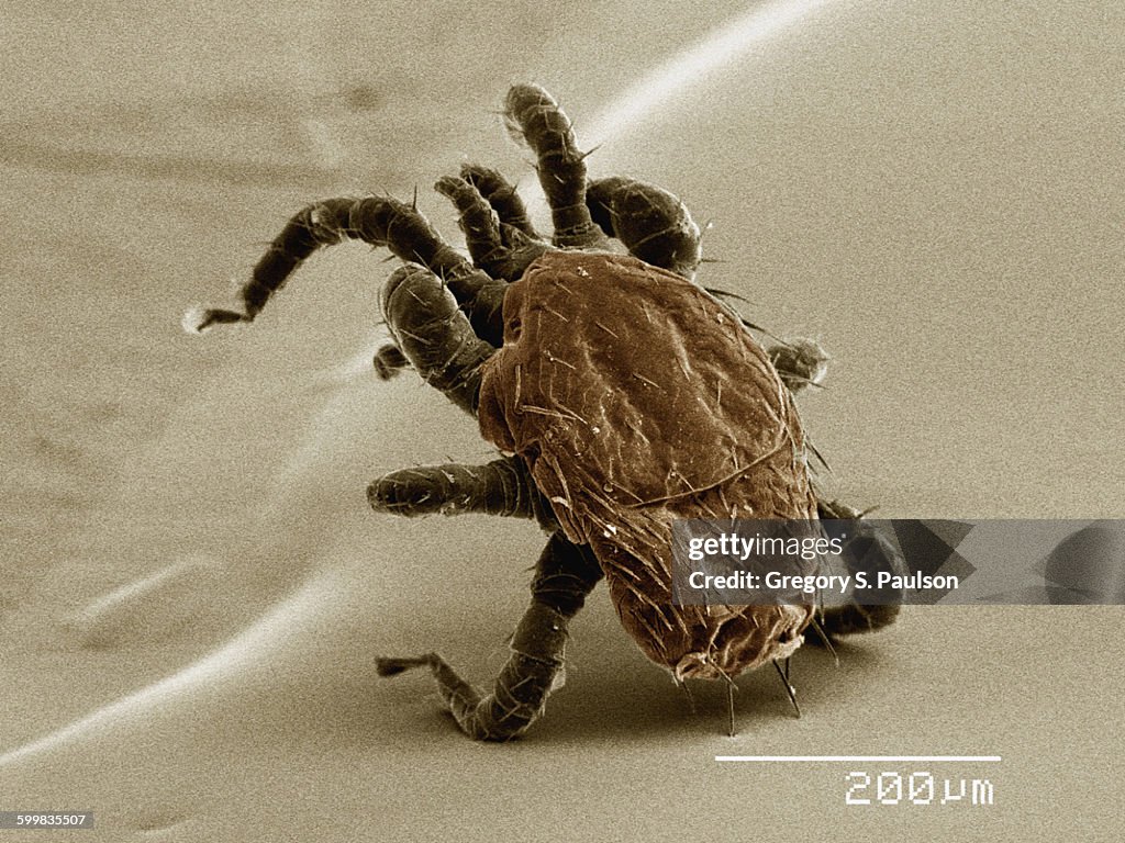 Coloured SEM of ectoparasitic mite collected from bat