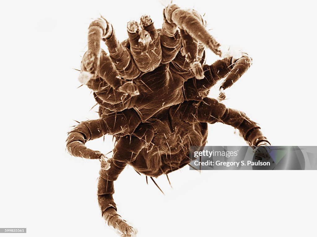Coloured SEM of ectoparasitic mite collected from bat