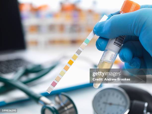 urine sample with test strip showing results - urine sample fotografías e imágenes de stock