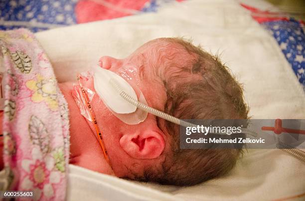 Neonatal O2 Baby Oxygen Mask Photos and Premium High Res Pictures - Getty Images