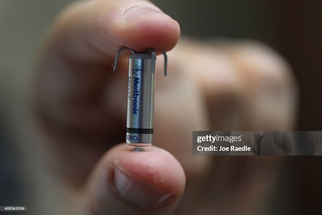 Smallest Pacemaker In The World Ivan Mendoza, MD, associate medical director for the Jackson Medical ...