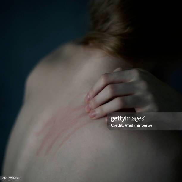 caucasian teenage girl scratching her shoulder - juckreiz stock-fotos und bilder