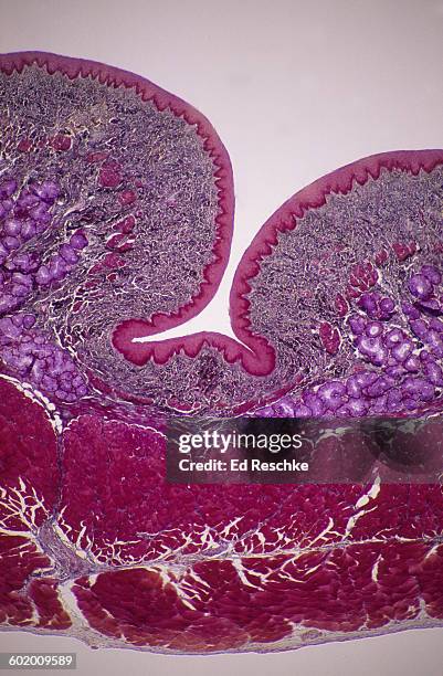 esophagus-mucosa, submucosa, muscularis,adventitia - epitélio escamoso imagens e fotografias de stock