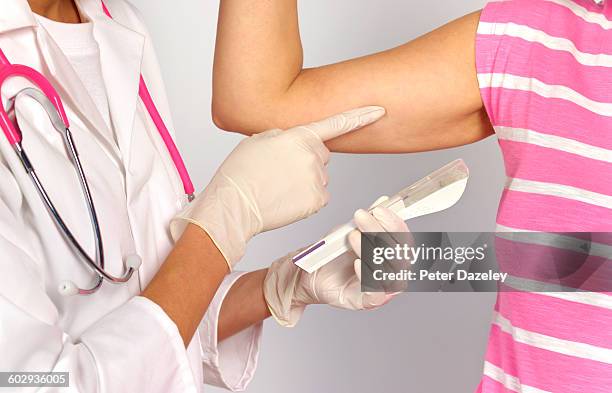 doctor with contraceptive implant - birth control stockfoto's en -beelden