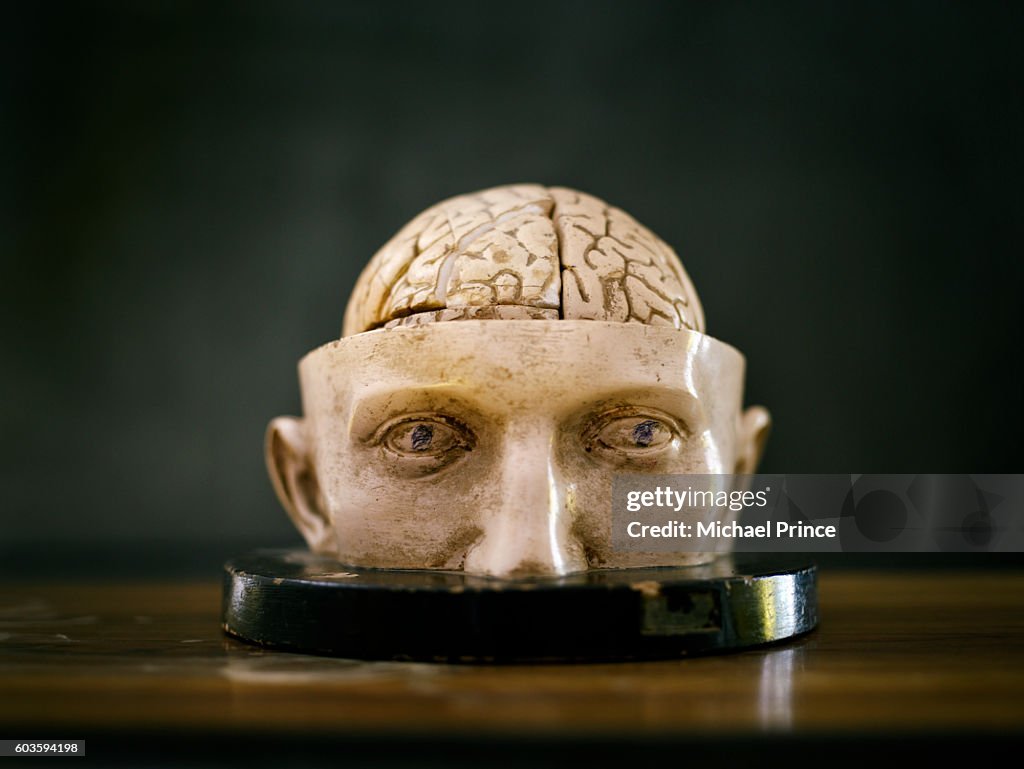 Model of Human Skull with Brain Exposed