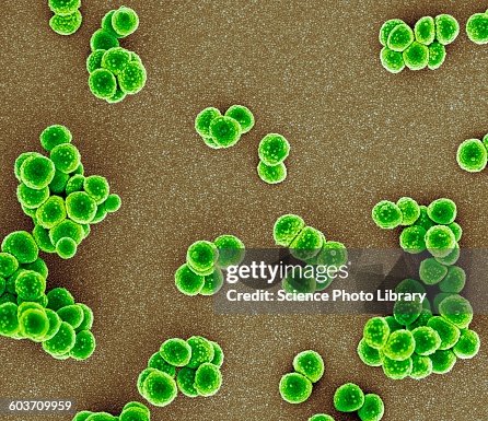 MRSA bacteria, SEM MRSA bacteria, SEM