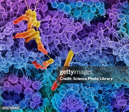 Oral bacteria, SEM Oral bacteria, SEM