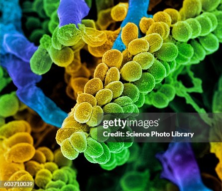 Streptococcus bacteria, SEM Streptococcus bacteria, SEM