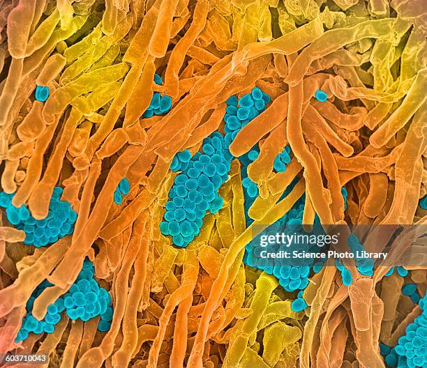 streptomyces coelicoflavus bacteria, sem - streptomyces stock illustrations