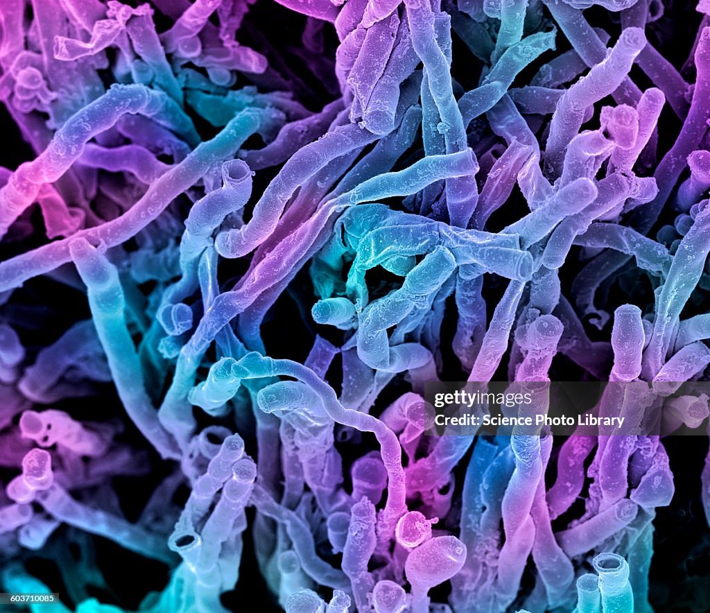 Actinomyces viscosus bacteria, SEM