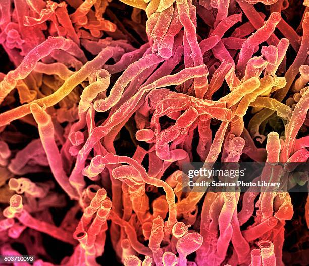 illustrations, cliparts, dessins animés et icônes de actinomyces viscosus bacteria, sem - vue au microscope électronique à balayage en réflexion