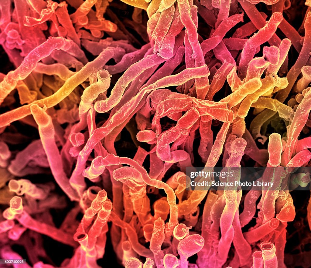 Actinomyces viscosus bacteria, SEM