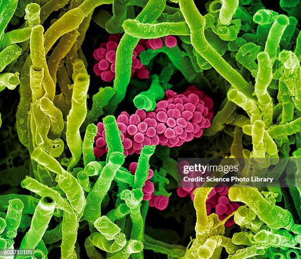 streptomyces coelicoflavus bacteria, sem - electron micrograph stock illustrations