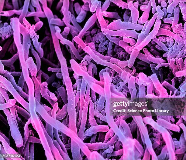 streptomyces coelicoflavus bacteria, sem - electron micrograph stock illustrations