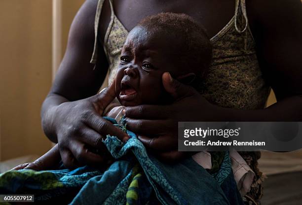 Esther Fulayitoni holds her daughter, Emily, 9 months, who is suffering from severe malnutrition at the Ngalou Rural Hospital, on September 9, 2016...