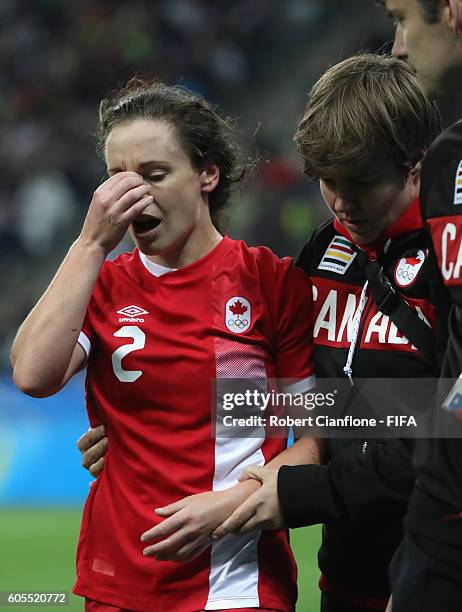 Allysha Chapman of Canada leaves the ground with an injury during the Women's Football Quarter Final match between Canada and France on Day 7 of the...