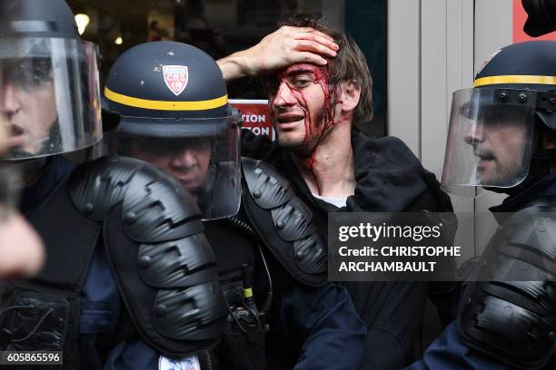 Man bleeds after being injured following clashes with French riot police during a demonstration against the controversial labour reforms of the...