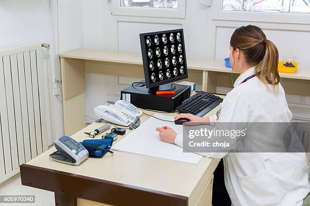 pretty young woman doctor checking  cat scan picture - cat scan imagens e fotografias de stock