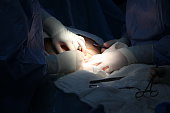 C-section surgery