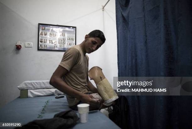 Mohannad Aid, a 20-year-old Palestinian who lost his leg when he was hit by a rocket during the 50-day war between Israel and Hamas militants in the...