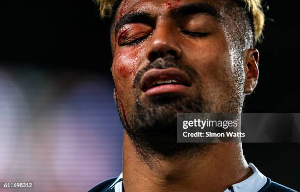 Lolagi Visinia of Auckland leaves the field with a facial injury during the round seven Mitre 10 Cup match between Auckland and Otago at Eden Park on...