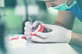 Dental prosthesis, dentures, prosthetics work.