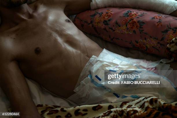 Fighter loyal to Libya's Government of National Accord forces lies on a bed at Misrata Central Hospital, between Sirte and Tripoli, on October 3 a...