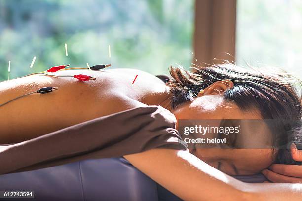 young woman at the acupuncture treatment - electrode stock pictures, royalty-free photos & images