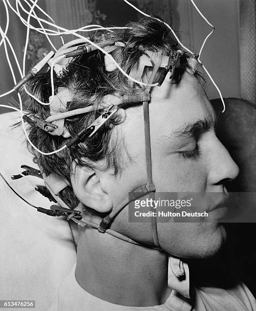 Joe Pickard with 14 electrodes fixed to his scalp to record the rythmic electrical signals sent out by his brain. The wires lead away to an...