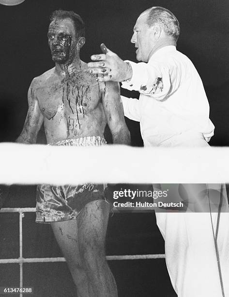 British Empire Heavyweight Champion Henry Cooper, with blood streaming from his left eye, is told by referee Tommy Little, that the fight is over....
